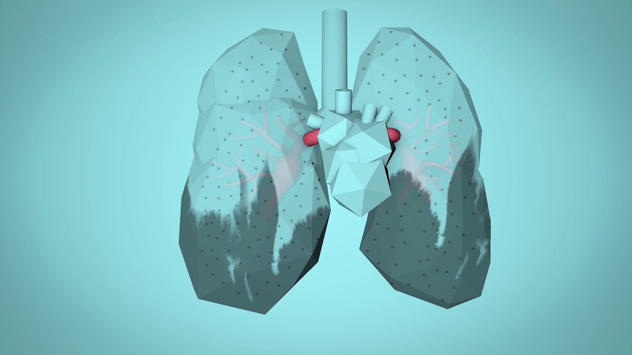 Is Air Pollution Increasing the COVID-19 Death Rate?